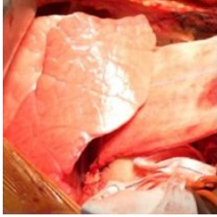 Umugabo w’imyaka 39 yahawe ibihaha by’ingurube, abimarana iminsi icyenda